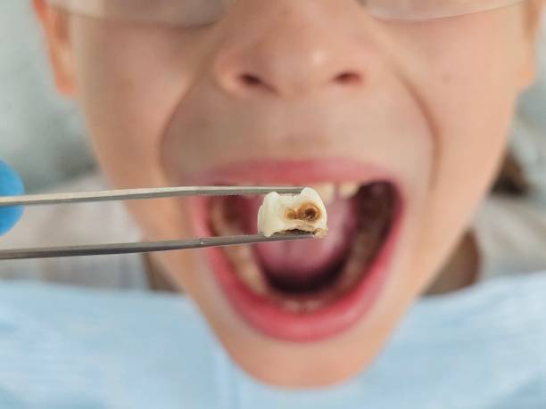 Best After-Hours Emergency Dentist in Ozk, AR